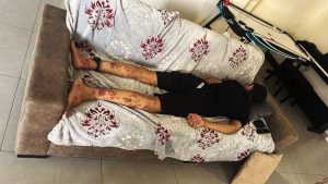 Scopri di più sull'articolo La detenzione del 13enne Iyad ha lasciato segni nel corpo e nell’anima