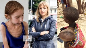 Scopri di più sull'articolo Mentre la Sardone vomita razzismo 65 paesi nel mondo soffrono la fame